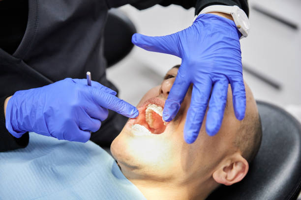 Best Dental Abscess Treatment in Cottage Grove, MN